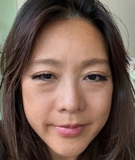 Book an Appointment with Irene Hu for Acupuncture